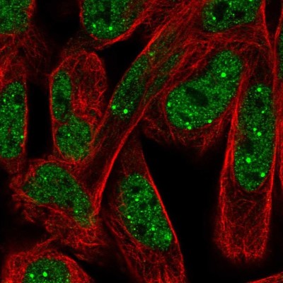 Immunocytochemistry/Immunofluorescence: NPAT Antibody [NBP2-58659] - Staining of human cell line RH-30 shows localization to nucleoplasm & nuclear bodies.