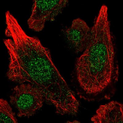 Immunocytochemistry/Immunofluorescence: MGST3 Antibody [NBP2-58678] - Staining of human cell line PC-3 shows localization to nucleus.