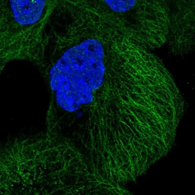 Immunocytochemistry/Immunofluorescence: DIAPH3 Antibody [NBP2-58613] - Staining of human cell line A-431 shows localization to plasma membrane & microtubules.
