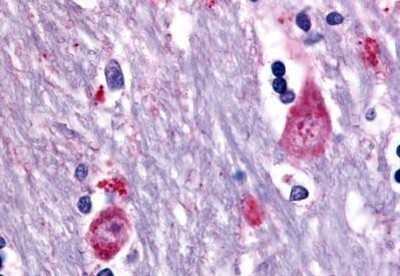 Immunohistochemistry-Paraffin: Muscarinic Acetylcholine Receptor M3/CHRM3 Antibody [NB100-59004] - Analysis of anti-CHRM3 / M3 antibody with human brain, caudate concentration 10 ug/ml.