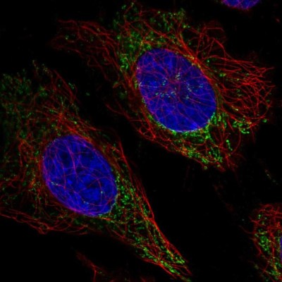Immunocytochemistry/Immunofluorescence: FAM160A2 Antibody [NBP2-56575] - Staining of human cell line HeLa shows localization to mitochondria.