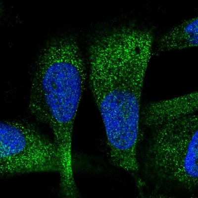 Immunocytochemistry/Immunofluorescence: ZC3H7A Antibody [NBP2-56811] - Staining of human cell line U-251 MG shows localization to cytosol.