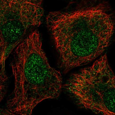 Immunocytochemistry/Immunofluorescence: TUT1 Antibody [NBP2-56631] - Staining of human cell line HaCaT shows localization to nucleus.