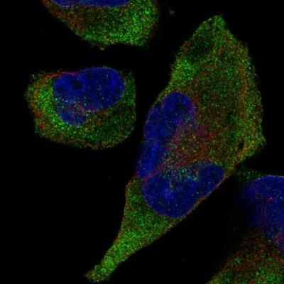 Immunocytochemistry/Immunofluorescence: TRIM9 Antibody [NBP2-58964] - Staining of human cell line RH-30 shows localization to cytosol.