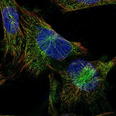 Immunocytochemistry/Immunofluorescence: PLC-beta 4 Antibody [NBP2-58912] - Staining of human cell line U-251 MG shows localization to microtubules.