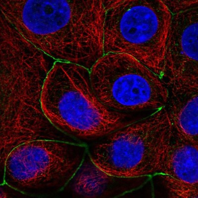 Immunocytochemistry/Immunofluorescence: Lnx1 Antibody [NBP2-58844] - Staining of human cell line MCF7 shows localization to cell junctions.