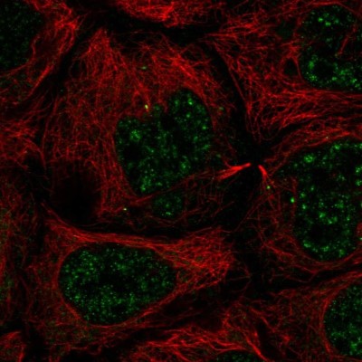 Immunocytochemistry/Immunofluorescence: SLC35A4 Antibody [NBP2-56943] - Staining of human cell line CACO-2 shows localization to nucleoplasm.