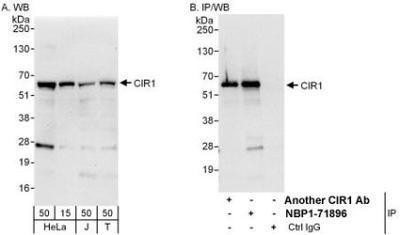 Western Blot: CBF1-interacting corepressor Antibody [NBP1-71896] - Whole cell lysate from HeLa (15 and 50 mcg for WB; 1 mg for IP, 20% of IP loaded), Jurkat (J; 50 mcg) and 293T (T; 50 mcg) cells.   Antibodies: Affinity purified rabbit anti-CIR1 antibody used for WB at 0.1 mcg/ml (A) and 1 mcg/ml (B) and used for IP at 6 mcg/mg lysate.  CIR1 was also immunoprecipitated by another rabbit anti-CIR1 antibody which recognizes an upstream epitope.