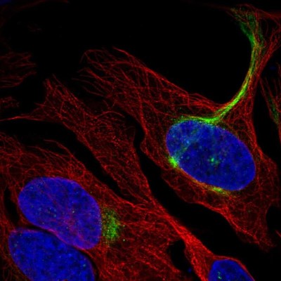 Immunocytochemistry/Immunofluorescence: C19orf25 Antibody [NBP2-56954] - Staining of human cell line U-2 OS shows localization to intermediate filaments.