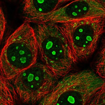 Immunocytochemistry/Immunofluorescence: PARP10 Antibody [NBP2-57056] - Staining of human cell line MCF7 shows localization to nucleoli, cytosol & vesicles.
