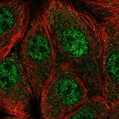 Immunocytochemistry/Immunofluorescence: CPSF1 Antibody [NBP2-57024] - Staining of human cell line MCF7 shows localization to nucleoplasm.
