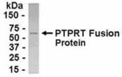 Western Blot: E coli-derived fusion protein as test antigen. Affinity-purified IgY dilution: 1:2000, Goat anti-IgY-HRP dilution: 1:1000. Colorimetric method for signal development. (anti-PTPRT)