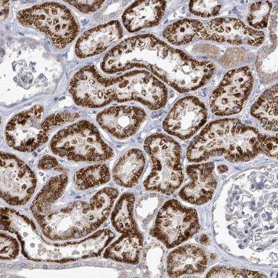 Immunohistochemistry: C3orf39 Antibody [NBP2-34067] - Staining of human kidney shows strong cytoplasmic positivity in cells in tubules.