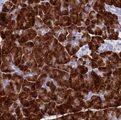 Immunohistochemistry-Paraffin: Aquaporin-12A Antibody [NBP2-54696] - Staining of human pancreas shows strong cytoplasmic positivity in exocrine glandular cells.