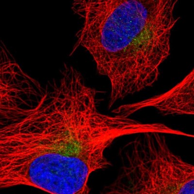 Immunocytochemistry/Immunofluorescence: SEC22C Antibody [NBP2-57179] - Staining of human cell line U-2 OS shows localization to the Golgi apparatus.