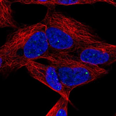Immunocytochemistry/Immunofluorescence: Dlx6 Antibody [NBP2-56915] - Staining of human cell line SH-SY5Y shows localization to nuclear bodies.