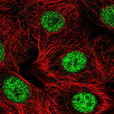 Immunocytochemistry/Immunofluorescence: SMARCD2 Antibody [NBP2-57074] - Staining of human cell line MCF7 shows localization to nucleoplasm.