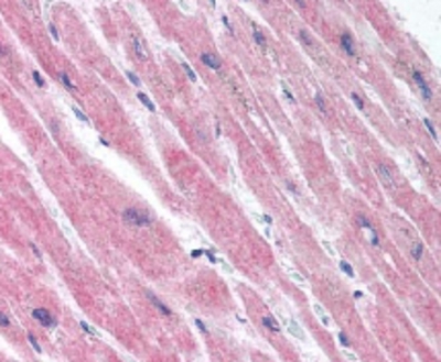 Immunohistochemistry: SOCS5 Antibody [NB600-1166] - IHC: Localization of the antibody as the precipitated red signal, with a hematoxylin purple nuclear counterstain in cardiac myocytes within the heart.