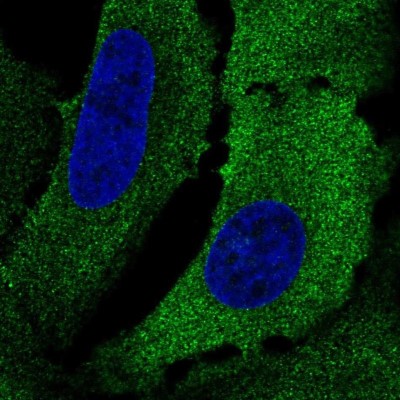 Immunocytochemistry/Immunofluorescence: Cytokeratin 75 Antibody [NBP2-56047] - Staining of human cell line U-2 OS shows localization to cytosol.