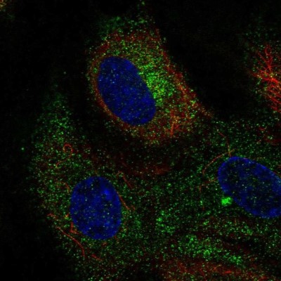 Immunocytochemistry/Immunofluorescence: CLEC14A Antibody [NBP2-56335] - Staining of human cell line HUVEC TERT2 shows localization to endoplasmic reticulum.