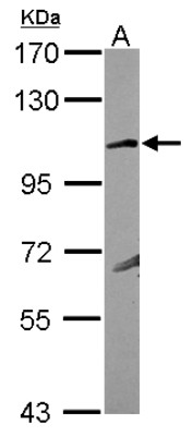 Western Blot: Glutamate Receptor KA1 Antibody [NBP2-16682] - Sample (30 ug of whole cell lysate) A: MCF-77. 5% SDS PAGE gel, diluted at 1:1000.