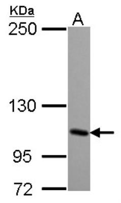 Western Blot: KA1/GRIK4/Glutamate Receptor KA1 Antibody [NBP2-16683] -  Sample (30 ug of whole cell lysate) A: NT2D1 5% SDS PAGE gel, diluted at 1:2000.