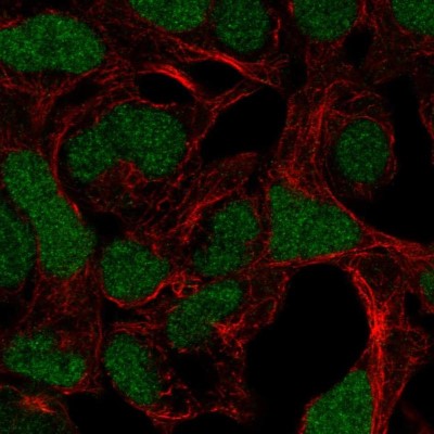 Immunocytochemistry/Immunofluorescence: ADAMTS17 Antibody [NBP2-56304] - Staining of human cell line HEK 293 shows localization to nucleus.