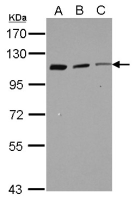 Western Blot: CORO7 Antibody [NBP2-14916] - Sample (30 ug of whole cell lysate) A: Raji B: K562 C: THP-1 7.5% SDS PAGE; antibody diluted at 1:1000.