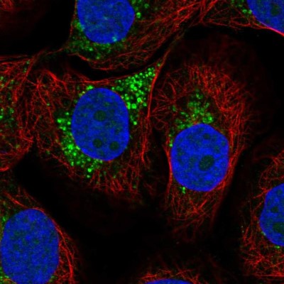 Immunocytochemistry/Immunofluorescence: LAPTM4A Antibody [NBP2-57151] - Staining of human cell line HaCaT shows localization to vesicles.