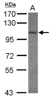 Western Blot: Glutamate Receptor 7 Antibody [NBP2-16681] - Sample (30 ug of whole cell lysate) A: NT2D1 7. 5% SDS PAGE gel, diluted at 1:1000.