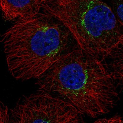 Immunocytochemistry/Immunofluorescence: RER1 Antibody [NBP2-57144] - Staining of human cell line A-431 shows localization to the Golgi apparatus.