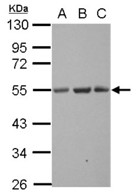 Western Blot: Synaptotagmin 13 Antibody [NBP2-20546] - Sample (30 ug of whole cell lysate) A: NT2D1 B: U87-MG C: SK-N-SH 10% SDS PAGE gel, diluted at 1:1000.