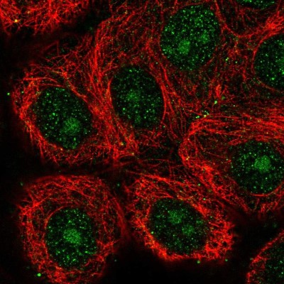 Immunocytochemistry/Immunofluorescence: GIN-1 Antibody [NBP2-57112] - Staining of human cell line MCF7 shows localization to nucleus & nucleoli.