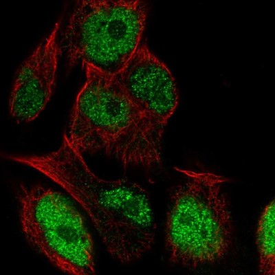 Immunocytochemistry/Immunofluorescence: LRRC28 Antibody [NBP2-57080] - Staining of human cell line SK-MEL-30 shows localization to nucleoplasm.