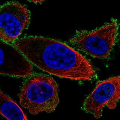 Immunocytochemistry/Immunofluorescence: Gastrin-releasing Peptide R/GRPR Antibody [NBP2-57398] - Staining of human cell line PC-3 shows localization to plasma membrane.