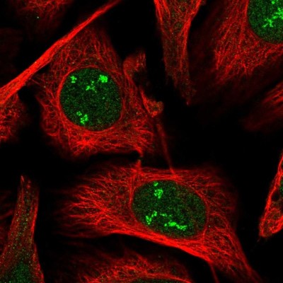 Immunocytochemistry/Immunofluorescence: POLR1A Antibody [NBP2-56122] - Staining of human cell line U-2 OS shows localization to nucleus & nucleoli fibrillar center.