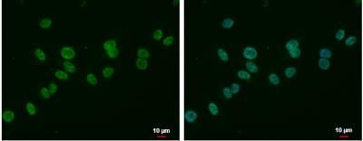 Immunocytochemistry/Immunofluorescence: MLLT6 Antibody [NBP2-17307] -  A375 cells were fixed in 4% paraformaldehyde at RT for 15 min. Green: MLLT6 protein stained by MLLT6 antibody  diluted at 1:500. Blue: Hoechst 33342 staining. Scale bar = 10 um.