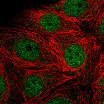 Immunocytochemistry/Immunofluorescence: SMARCD2 Antibody [NBP2-56267] - Staining of human cell line MCF7 shows localization to nucleoplasm.