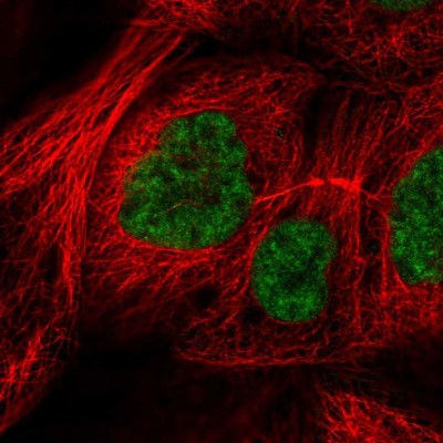 Immunocytochemistry/Immunofluorescence: RSRC2 Antibody [NBP2-56385] - Staining of human cell line A-431 shows localization to nuclear speckles.