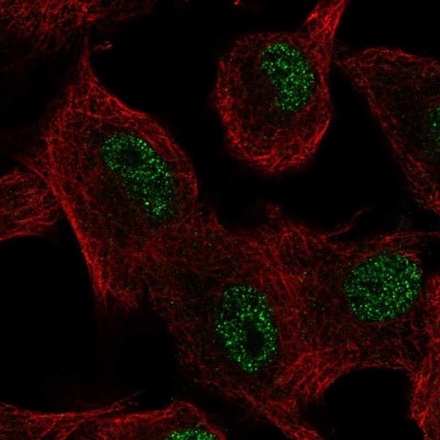 Immunocytochemistry/Immunofluorescence: SLC39A11 Antibody [NBP2-58224] - Staining of human cell line A549 shows localization to nucleoplasm.