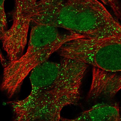 Immunocytochemistry/Immunofluorescence: ACSBG1 Antibody [NBP2-58214] - Staining of human cell line SK-MEL-30 shows localization to nucleus & vesicles.