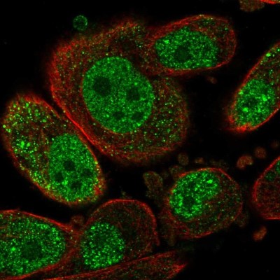 Immunocytochemistry/Immunofluorescence: SETD6 Antibody [NBP2-58089] - Staining of human cell line PC-3 shows localization to nucleoplasm.