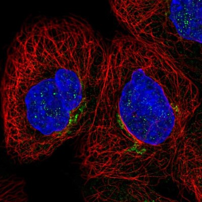 Immunocytochemistry/Immunofluorescence: Cytochrome b reductase 1 Antibody [NBP2-58323] - Staining of human cell line A-431 shows localization to the Golgi apparatus.
