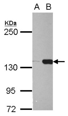 Western Blot: BCOR Antibody [NBP2-15560] - Sample (30 ug of whole cell lysate) A: HeLa B: HeLa nucleus 5% SDS PAGE gel, diluted at 1:1000.