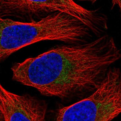 Immunocytochemistry/Immunofluorescence: DDX28 Antibody [NBP2-58209] - Staining of human cell line U-2 OS shows localization to mitochondria.
