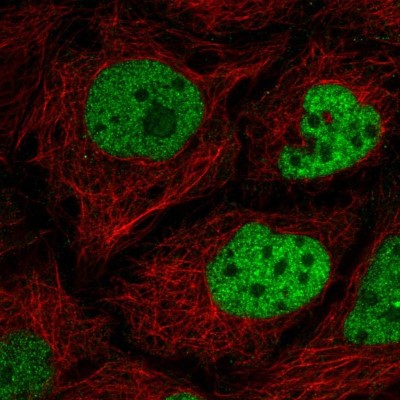 Immunocytochemistry/Immunofluorescence: C2orf49 Antibody [NBP2-56365] - Staining of human cell line CACO-2 shows localization to nucleoplasm.