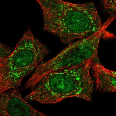 Immunocytochemistry/Immunofluorescence: CLPX Antibody [NBP2-56426] - Staining of human cell line A549 shows localization to nucleoplasm, cytosol & mitochondria.