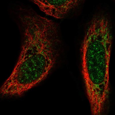 Immunocytochemistry/Immunofluorescence: Neuroglycan C/CSPG5 Antibody [NBP2-56381] - Staining of human cell line U-2 OS shows localization to nuclear speckles & mitochondria.