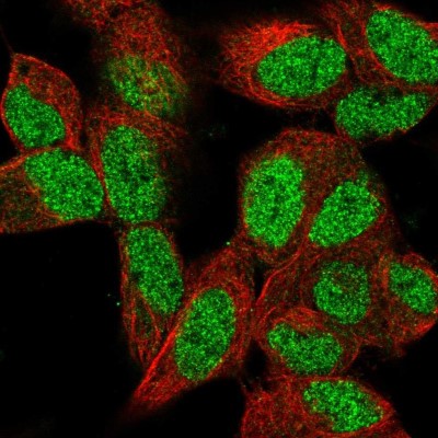Immunocytochemistry/Immunofluorescence: MEL-18 Antibody [NBP2-56458] - Staining of human cell line SH-SY5Y shows localization to nucleus.