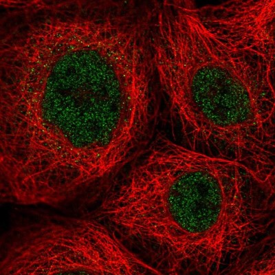 Immunocytochemistry/Immunofluorescence: ZNF22 Antibody [NBP2-58405] - Staining of human cell line A-431 shows localization to nucleoplasm.